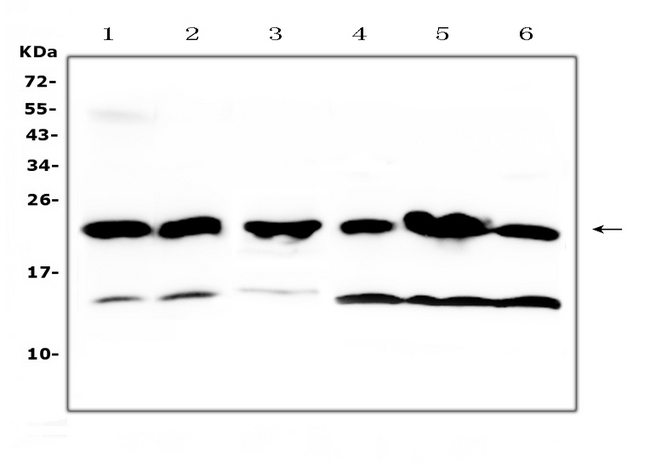 GSTP1 / GST Pi Antibody - Western blot analysis of GST3 / GST pi using anti-GST3 / GST pi antibody. Electrophoresis was performed on a 5-20% SDS-PAGE gel at 70V (Stacking gel) / 90V (Resolving gel) for 2-3 hours. The sample well of each lane was loaded with 50ug of sample under reducing conditions. Lane 1: mouse lung tissue lysates, Lane 2: mouse testis tissue lysates,Lane 3: rat spleen tissue lysates,Lane 4: human A549 whole cell lysates,Lane 5: human placenta tissue lysates,Lane 6: human Hela whole cell lysates. After Electrophoresis, proteins were transferred to a Nitrocellulose membrane at 150mA for 50-90 minutes. Blocked the membrane with 5% Non-fat Milk/ TBS for 1.5 hour at RT. The membrane was incubated with rabbit anti-GST3 / GST pi antigen affinity purified polyclonal antibody at 0.5 ug/mL overnight at 4?, then washed with TBS-0.1% Tween 3 times with 5 minutes each and probed with a goat anti-rabbit IgG-HRP secondary antibody at a dilution of 1:10000 for 1.5 hour at RT. The signal is developed using an Enhanced Chemiluminescent detection (ECL) kit with Tanon 5200 system. A specific band was detected for GST3 / GST pi at approximately 23KD. The expected band size for GST3 / GST pi is at 23KD.