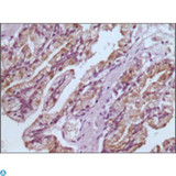 GSTP1 / GST Pi Antibody - Immunohistochemistry (IHC) analysis of paraffin-embedded human prostate tissues with DAB staining using GSTP1 Monoclonal Antibody.