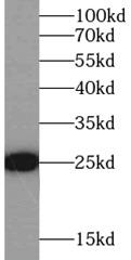 GSTP1 / GST Pi Antibody - Jurkat cells were subjected to SDS PAGE followed by western blot with GSTP1 antibody at dilution of 1:1000