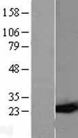 GSTP1 / GST Pi Protein - Western validation with an anti-DDK antibody * L: Control HEK293 lysate R: Over-expression lysate