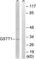 GSTT1+4 Antibody - Western blot analysis of lysates from Jurkat cells, using GSTT1/4 Antibody. The lane on the right is blocked with the synthesized peptide.