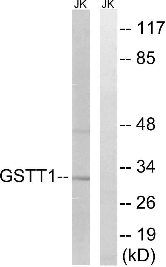 GSTT1+4 Antibody - Western blot analysis of extracts from Jurkat cells, using GSTT1/4 antibody.