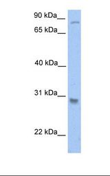 GSTT1 Antibody - Jurkat cell lysate. Antibody concentration: 1.0 ug/ml. Gel concentration: 12%.  This image was taken for the unconjugated form of this product. Other forms have not been tested.