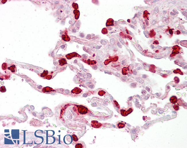 GSTT1 Antibody - Anti-GSTT1 antibody IHC of human lung. Immunohistochemistry of formalin-fixed, paraffin-embedded tissue after heat-induced antigen retrieval. Antibody concentration 5 ug/ml.  This image was taken for the unconjugated form of this product. Other forms have not been tested.