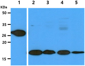 GSTT1 Antibody - The recombinant human GSTT1 (50ng) and Cell lysates (40ug) were resolved by SDS-PAGE, transferred to PVDF membrane and probed with anti-human GSTT1 antibody (1:1000). Proteins were visualized using a goat anti-mouse secondary antibody conjugated to HRP and an ECL detection system. Lane 1.: GSTT1 Recombinant protein Lane 2.: HeLa cell lysate Lane 3.: 293T cell lysate Lane 4.: Jurkat cell lysate Lane 5.: HL-60 cell lysate