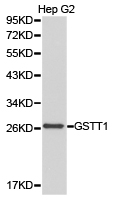 GSTT1 Antibody - Western blot of extracts of HepG2 cell lines, using GSTT1 antibody.