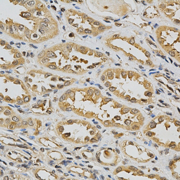 GSTT1 Antibody - Immunohistochemistry of paraffin-embedded human kidney tissue.