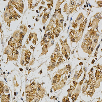 GSTT1 Antibody - Immunohistochemistry of paraffin-embedded human stomach tissue.
