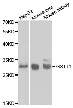 GSTT1 Antibody - Western blot analysis of extracts of various cell lines, using GSTT1 antibody at 1:1000 dilution. The secondary antibody used was an HRP Goat Anti-Rabbit IgG (H+L) at 1:10000 dilution. Lysates were loaded 25ug per lane and 3% nonfat dry milk in TBST was used for blocking.