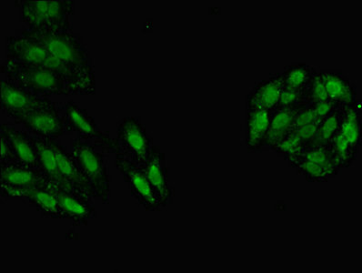 GSTT1 Antibody - Immunofluorescent analysis of HepG2 cells using GSTT1 Antibody at dilution of 1:100 and Alexa Fluor 488-congugated AffiniPure Goat Anti-Rabbit IgG(H+L)