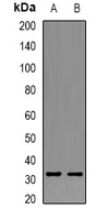 GSTT1 Antibody - Western blot analysis of GSTT1 expression in HepG2 (A); mouse liver (B) whole cell lysates.