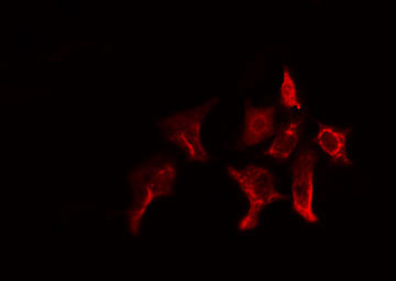 GSTT1 Antibody - Staining HeLa cells by IF/ICC. The samples were fixed with PFA and permeabilized in 0.1% Triton X-100, then blocked in 10% serum for 45 min at 25°C. The primary antibody was diluted at 1:200 and incubated with the sample for 1 hour at 37°C. An Alexa Fluor 594 conjugated goat anti-rabbit IgG (H+L) antibody, diluted at 1/600, was used as secondary antibody.