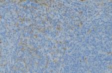GSTT1 Antibody - 1:100 staining human lymph node tissue by IHC-P. The sample was formaldehyde fixed and a heat mediated antigen retrieval step in citrate buffer was performed. The sample was then blocked and incubated with the antibody for 1.5 hours at 22°C. An HRP conjugated goat anti-rabbit antibody was used as the secondary.