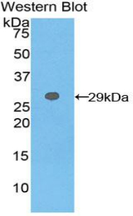 GSTT2 Antibody - Western blot of recombinant GSTT2.  This image was taken for the unconjugated form of this product. Other forms have not been tested.