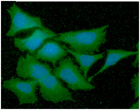 GSTT2 Antibody - ICC/IF analysis of GSTT2 in HeLa cells line, stained with DAPI (Blue) for nucleus staining and monoclonal anti-human GSTT2 antibody (1:100) with goat anti-mouse IgG-Alexa fluor 488 conjugate (Green).