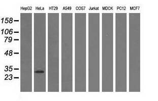 GSTT2 Antibody - Western blot of extracts (35 ug) from 9 different cell lines by using anti-GSTT2 monoclonal antibody.
