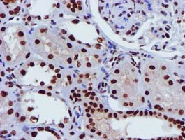 GSTT2 Antibody - IHC of paraffin-embedded Human Kidney tissue using anti-GSTT2 mouse monoclonal antibody.