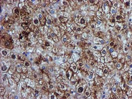 GSTT2 Antibody - IHC of paraffin-embedded Human liver tissue using anti-GSTT2 mouse monoclonal antibody.