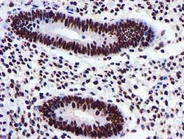GSTT2 Antibody - IHC of paraffin-embedded Human endometrium tissue using anti-GSTT2 mouse monoclonal antibody.