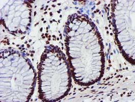 GSTT2 Antibody - IHC of paraffin-embedded Human colon tissue using anti-GSTT2 mouse monoclonal antibody.