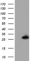 GSTT2 Antibody - HEK293T cells were transfected with the pCMV6-ENTRY control (Left lane) or pCMV6-ENTRY GSTT2 (Right lane) cDNA for 48 hrs and lysed. Equivalent amounts of cell lysates (5 ug per lane) were separated by SDS-PAGE and immunoblotted with anti-GSTT2.