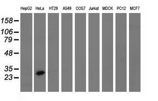 GSTT2 Antibody - Western blot analysis of extracts (35ug) from 9 different cell lines by using anti-GSTT2 monoclonal antibody.