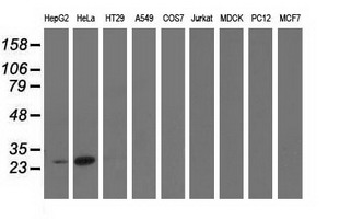 GSTT2 Antibody - Western blot analysis of extracts (35ug) from 9 different cell lines by using anti-GSTT2 monoclonal antibody.