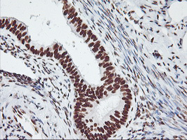GSTT2 Antibody - IHC of paraffin-embedded Human endometrium tissue using anti-GSTT2 mouse monoclonal antibody.