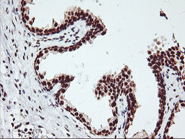 GSTT2 Antibody - IHC of paraffin-embedded Human prostate tissue using anti-GSTT2 mouse monoclonal antibody.