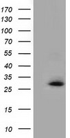 GSTT2 Antibody - HEK293T cells were transfected with the pCMV6-ENTRY control (Left lane) or pCMV6-ENTRY GSTT2 (Right lane) cDNA for 48 hrs and lysed. Equivalent amounts of cell lysates (5 ug per lane) were separated by SDS-PAGE and immunoblotted with anti-GSTT2.