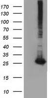 GSTT2 Antibody - HEK293T cells were transfected with the pCMV6-ENTRY control (Left lane) or pCMV6-ENTRY GSTT2 (Right lane) cDNA for 48 hrs and lysed. Equivalent amounts of cell lysates (5 ug per lane) were separated by SDS-PAGE and immunoblotted with anti-GSTT2.