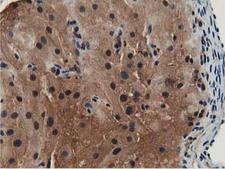 GSTT2 Antibody - IHC of paraffin-embedded Human Ovary tissue using anti-GSTT2 mouse monoclonal antibody.