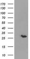 GSTT2 Antibody - HEK293T cells were transfected with the pCMV6-ENTRY control (Left lane) or pCMV6-ENTRY GSTT2 (Right lane) cDNA for 48 hrs and lysed. Equivalent amounts of cell lysates (5 ug per lane) were separated by SDS-PAGE and immunoblotted with anti-GSTT2.