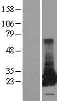 GSTT2 Protein - Western validation with an anti-DDK antibody * L: Control HEK293 lysate R: Over-expression lysate