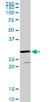 GSTZ1 Antibody - GSTZ1 monoclonal antibody (M01), clone 1G12. Western Blot analysis of GSTZ1 expression in PC-12.