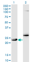 GSTZ1 Antibody - Western Blot analysis of GSTZ1 expression in transfected 293T cell line by GSTZ1 monoclonal antibody (M01), clone 1G12.Lane 1: GSTZ1 transfected lysate (Predicted MW: 24.1 KDa).Lane 2: Non-transfected lysate.