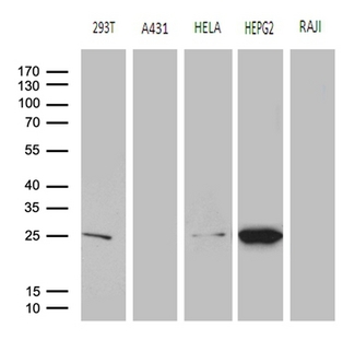 GSTZ1 Antibody - Western blot analysis of extracts. (35ug) from 5 different cell lines by using anti-GSTZ1 monoclonal antibody. (1:500)