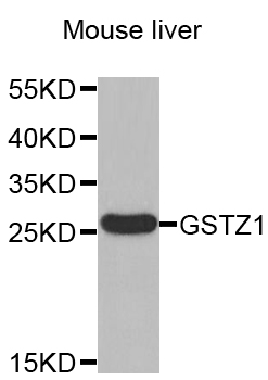 GSTZ1 Antibody - Western blot analysis of extracts of Mouse liver .
