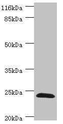 GSTZ1 Antibody - Western blot All Lanes:GSTZ1 antibody at 0.41ug/ml+Mouse liver tissue Secondary Goat polyclonal to rabbit at 1/10000 dilution Predicted band size: 25,18,20 kDa Observed band size: 24 kDa
