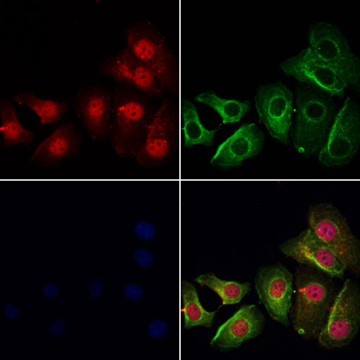 GSTZ1 Antibody - Staining HeLa cells by IF/ICC. The samples were fixed with PFA and permeabilized in 0.1% Triton X-100, then blocked in 10% serum for 45 min at 25°C. Samples were then incubated with primary Ab(1:200) and mouse anti-beta tubulin Ab(1:200) for 1 hour at 37°C. An AlexaFluor594 conjugated goat anti-rabbit IgG(H+L) Ab(1:200 Red) and an AlexaFluor488 conjugated goat anti-mouse IgG(H+L) Ab(1:600 Green) were used as the secondary antibod