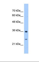 GSTZ1 Antibody - HepG2 cell lysate. Antibody concentration: 2.5 ug/ml. Gel concentration: 12%.  This image was taken for the unconjugated form of this product. Other forms have not been tested.