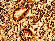 GSX1 / GSH1 Antibody - Immunohistochemistry image of paraffin-embedded human appendix tissue at a dilution of 1:100