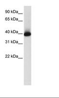 GSX2 / GSH2 Antibody - LN18 Lysate.  This image was taken for the unconjugated form of this product. Other forms have not been tested.