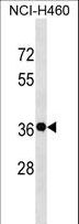 GSX2 / GSH2 Antibody - GSX2 Antibody western blot of NCI-H460 cell line lysates (35 ug/lane). The GSX2 antibody detected the GSX2 protein (arrow).