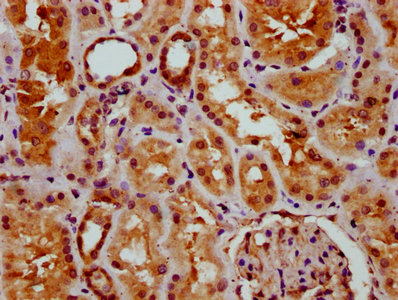 GSX2 / GSH2 Antibody - Immunohistochemistry Dilution at 1:400 and staining in paraffin-embedded human kidney tissue performed on a Leica BondTM system. After dewaxing and hydration, antigen retrieval was mediated by high pressure in a citrate buffer (pH 6.0). Section was blocked with 10% normal Goat serum 30min at RT. Then primary antibody (1% BSA) was incubated at 4°C overnight. The primary is detected by a biotinylated Secondary antibody and visualized using an HRP conjugated SP system.