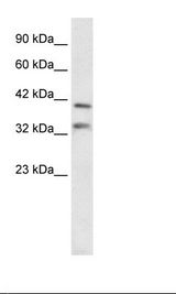 GSX2 / GSH2 Antibody - Fetal Liver Lysate.  This image was taken for the unconjugated form of this product. Other forms have not been tested.