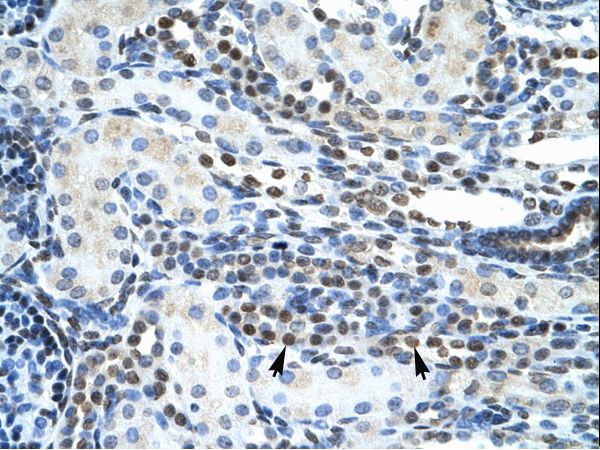 GSX2 / GSH2 Antibody - Human Kidney.  This image was taken for the unconjugated form of this product. Other forms have not been tested.