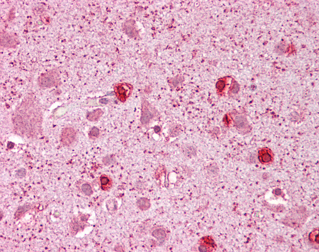 GSX2 / GSH2 Antibody - Anti-GSX2 / GSH2 antibody IHC of human brain, cortex. Immunohistochemistry of formalin-fixed, paraffin-embedded tissue after heat-induced antigen retrieval. Antibody concentration 5 ug/ml.  This image was taken for the unconjugated form of this product. Other forms have not been tested.