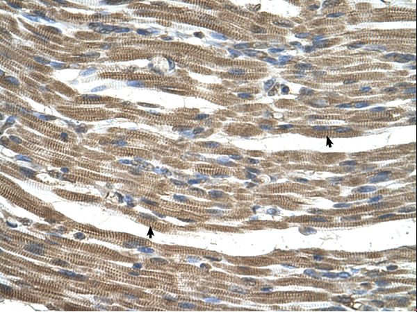 GT335 / ES1 Antibody - C21orf33 antibody C21ORF33 Antibody was used in IHC to stain formalin-fixed, paraffin-embedded human muscle.  This image was taken for the unconjugated form of this product. Other forms have not been tested.