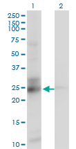 GT335 / ES1 Antibody - Western blot of C21orf33 expression in transfected 293T cell line by C21orf33 monoclonal antibody (M01), clone 1F5.